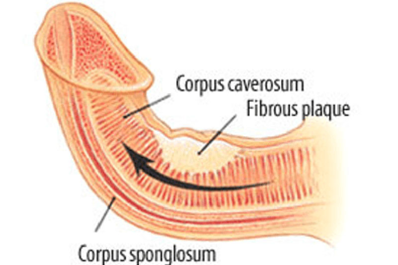 Acquistare sizegenetics